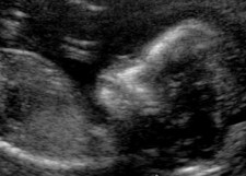 Bob (working title - inspired by a particularly random Blackadder storyline - circa 7 weeks